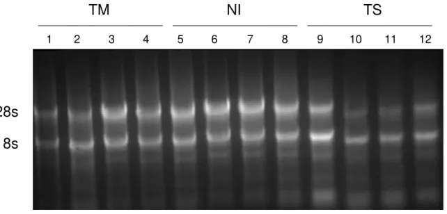 Figura  3:  Gel  de  agarose  a  1,2%,  representativo  da  integridade  das  amostras  de  RNA  extraídos