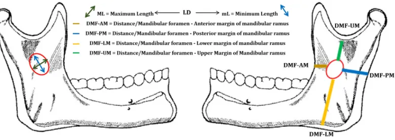 Figure 1. Scheme of the studied distances of the mandibular foramen in relation to the ramus, of the morphology and diameter of the  foramen itself