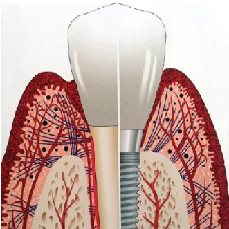 Figura  2.  Comparação  anatómica  entre  os  tecidos  de  suporte  periodontal  e  periimplantar