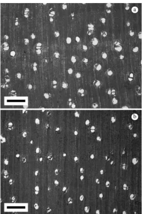 Figure 6. Axial variation of ray height (a), ray width (b)  and ray frequency (c) in Astronium graveolens wood