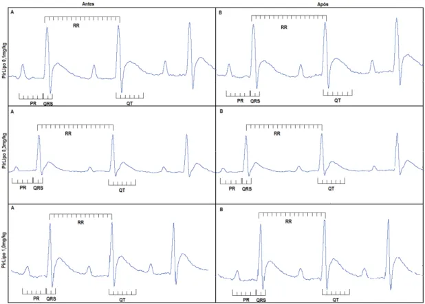 Figura  13:  Parâmetros  do  ECG  em  animais  antes  (A)  e  após  (B)  a  administração  IV  de  Piridostigmina  lipossomal