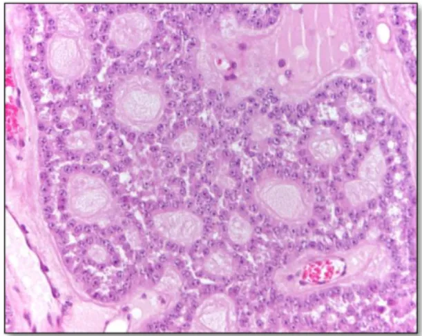 Figura  12  -  Tumor  da  granulosa.  Confirmado  por  exame histopatológico  pelo  Laboratório  da  UTAD e INIAV)