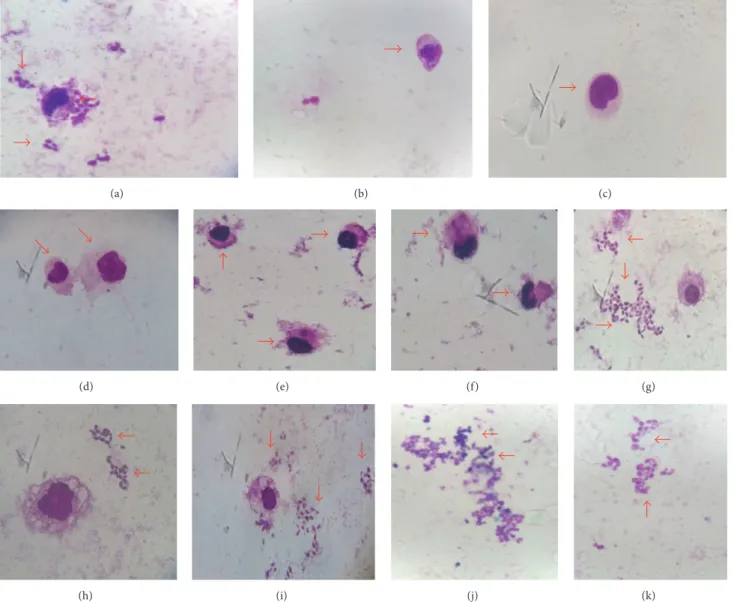 Figure 4: Antiamastigote activity of Handroanthus serratifolius. (a) Negative control; (b) macrophage without infection; (c) amphotericin B (50 