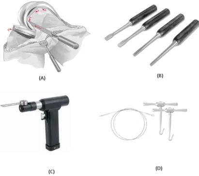 Figure 2.26: R.T.K.A. used materials, removal procedure (A); Mini-Lexer Osteotomes (B); Os- Os-cilating Saw (C); Gigli Saw (D)