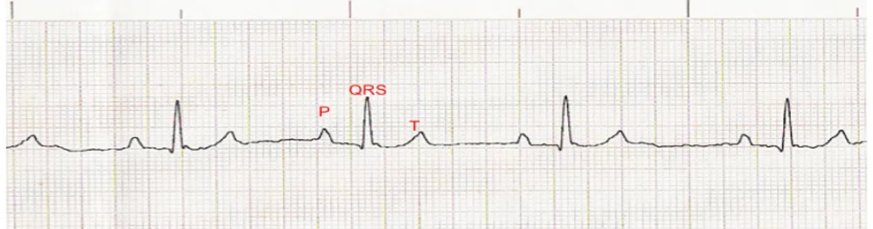 Figure 1: ECG tracing illustrating the P wave, QRS complex and T wave recorded from a normal Castro Laboreiro  Dog with standard bipolar II lead