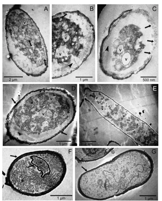 Figure  3  –  Transmission  electron  micrographs  of  effect  of  essential  oils  (EO)  at  0.1%  on  ultrastructure  of Pseudocercospora griseola conidia, strain 63-63