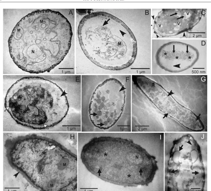 Figure  2  –  Transmission  electron  micrographs  of  effect  of  essential  oils  (EO)  at  0.1%  on  ultrastructure  of Pseudocercospora griseola conidia, strain 63-31