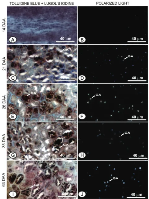 Figure 4: Cross-sections of carrot seed endosperm collected at 14 DAA (A and B), at 21 DAA (C and D), at 28 DAA  (E and F), at 35 DAA (G and H) and at 63 DAA (I and J)