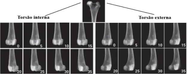 Figura  14:   Exemplos  de  radiografias  que  demonstram  um  correto  alinhamento  da  porção  proximal  do  fémur em projeção craniocaudal e o fémur distal encontra-se rodado em diferentes imagens de torsão com  aumentos de 5 º, interna e externamente