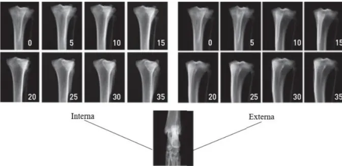 Figura 20:  Exemplos de radiografias que demonstram um correto alinhamento da porção distal da tíbia em projeção  craniocaudal  e  tíbia  proximal  encontra-se  rodada  em  diferentes  imagens  com  aumentos  de  5  º,  interna  e  externamente