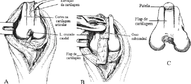 Figura 30:  Ilustração da técnica condroplastia troclear. Adaptado de (DeCamp, et al., 2016)
