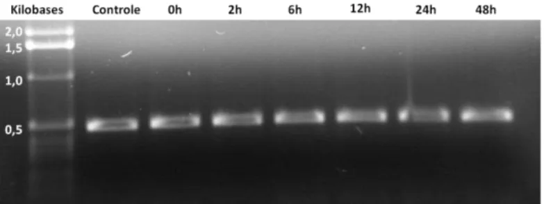 Figura  08.  Expressão  de  β-actina,  em  gel  de  agarose  0,8%,  obtida  pela  extração  de  RNA  total  de  células  H9c2