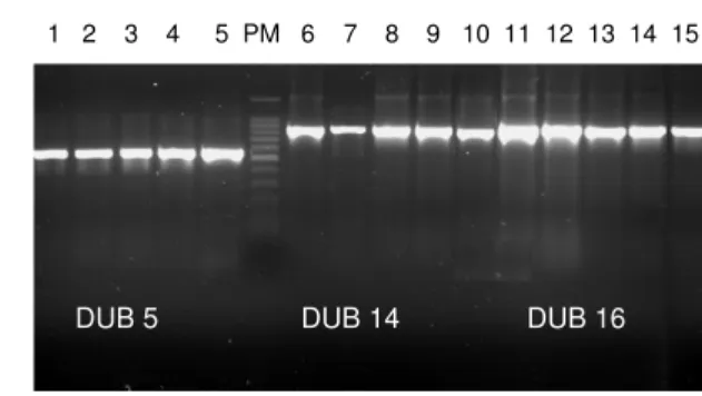 Figura  8  –  PCR  das  colônias.  Nas  canaletas  de  1  a  5  foram  aplicadas  alíquotas  dos  produtos  de  PCR  de  5  transformantes  contendo  o  gene  DUB  5