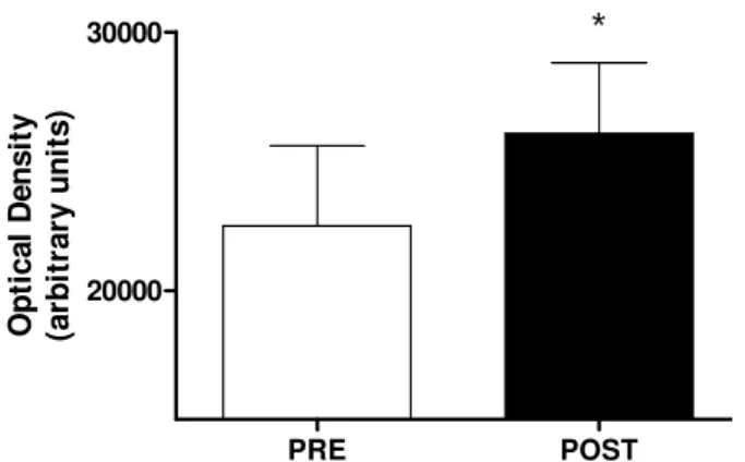 Figure  2.  Serum  α-actin  dosage  (Western  Blot);  there  was  a  significant  increase  in  the  post-training  period;  α-actin  pattern suggests detectable levels are on the order of µg; data expressed as mean ± SEM; *p=0,0004