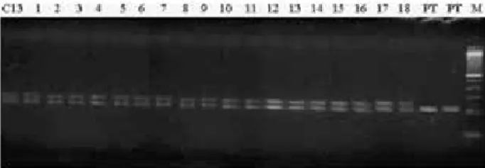 Figure 3. Amplified fragments of DNA using microsatellite primer CCSM  06 in some plants of the population evaluated