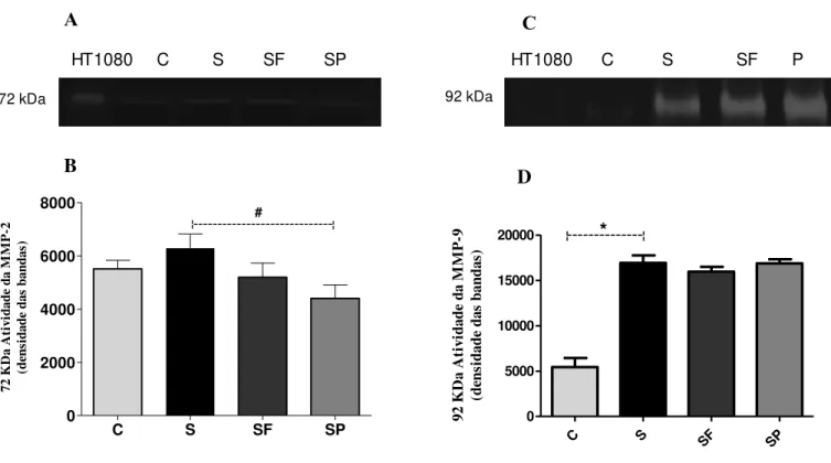 Figura  11.  Análise  da  atividade  enzimática  de  MMP-2  e  MMP-9  em  homogenato  de  tecido  hepático  de  camundongos  C57BL/6  controles  (C),  sépticos  (S),  sépticos  tratados  com  extrato  das  folhas (SF) ou com a polpa (SP) de Morus nigra L