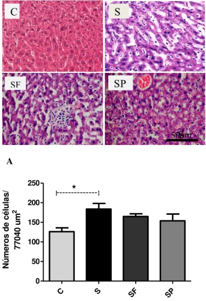 Fig  12.  Fotomicrografias  representativas  de  cortes  histológicos  de  fígado  (A)