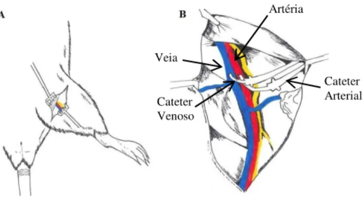 Figura 5: Esquema do implante de cateter na veia e artéria femoral. Em A, tem-se o local de dissecção do  trígono femoral