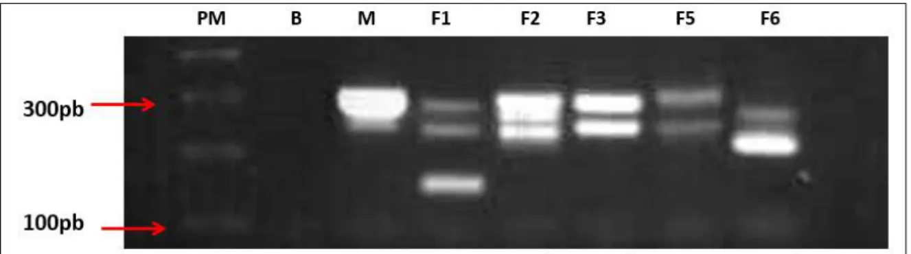 Figura  5:  Perfis genéticos das seis amostras de  DNA de  Trypanosoma  cruzi  provenientes de  pacientes da  região do Alto Paranaíba, MG, obtidos por meio da técnica de PCR-LSSP