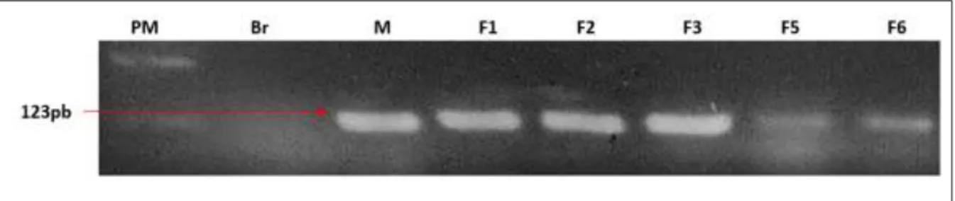 Figura 7: Controle de extração do DNA genômico das seis pacientes provenientes da região do Alto Paranaíba,  MG,  obtido  pela  técnica  de  PCR  convencional  do  gene  β-globina