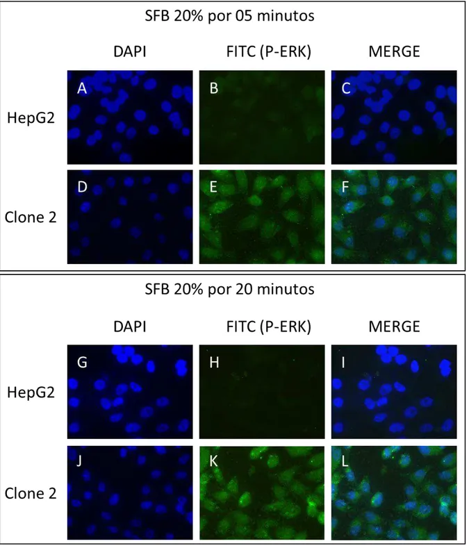 Figura 11: Detecção de p-ERK1/2 em células HepG2 (controle) e em células do CL2, induzidas com  20% de SFB por 5 e 20 minutos