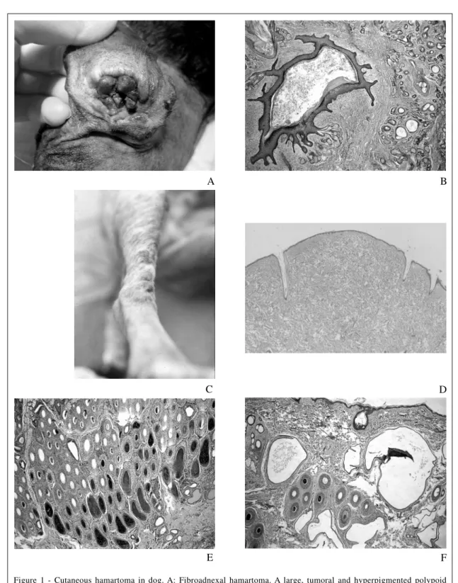 Figure 1 - Cutaneous hamartoma in dog. A: Fibroadnexal hamartoma. A large, tumoral and hyperpigmented polypoid lesion obstructing the external ear canal