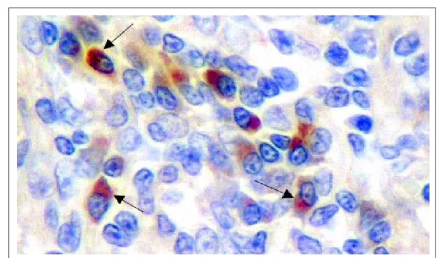 Figure 1 - Toxoplasma gondii immunoreactivity in canine epididymis inoculated with 1 x 10 6  Toxoplasma gondii tachyzoites