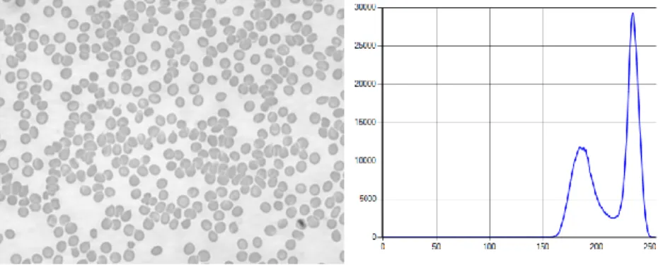 Figure 6 – Blood cells image and Image Histogram  