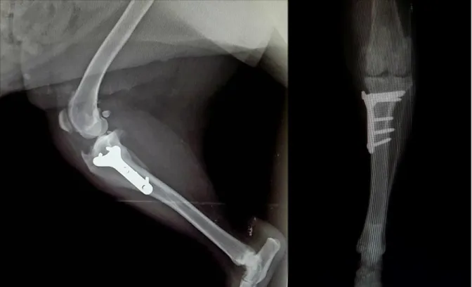 Figura  I.G  –  Radiografias  4  meses  pós-operatórias  em  projeções  mediolateral  (direita)  e  craniocaudal (esquerda), com regeneração óssea da fratura fibular 