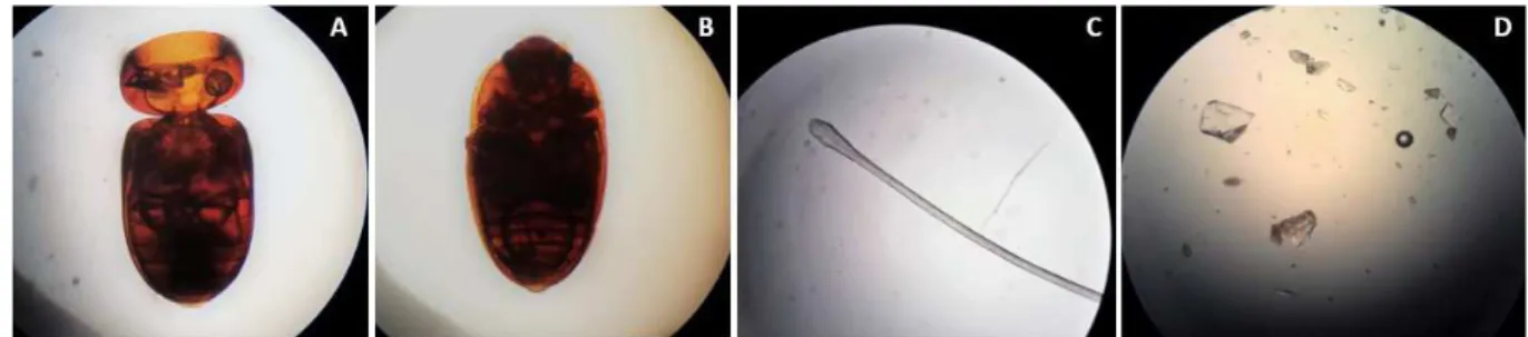 Figura 1 – Sujidades encontradas em amostras de orégano desidratado em flocos. Insetos inteiros de  diferentes espécies (A, B), pelo humano (C) e fragmentos de acrílico e vidro (D)