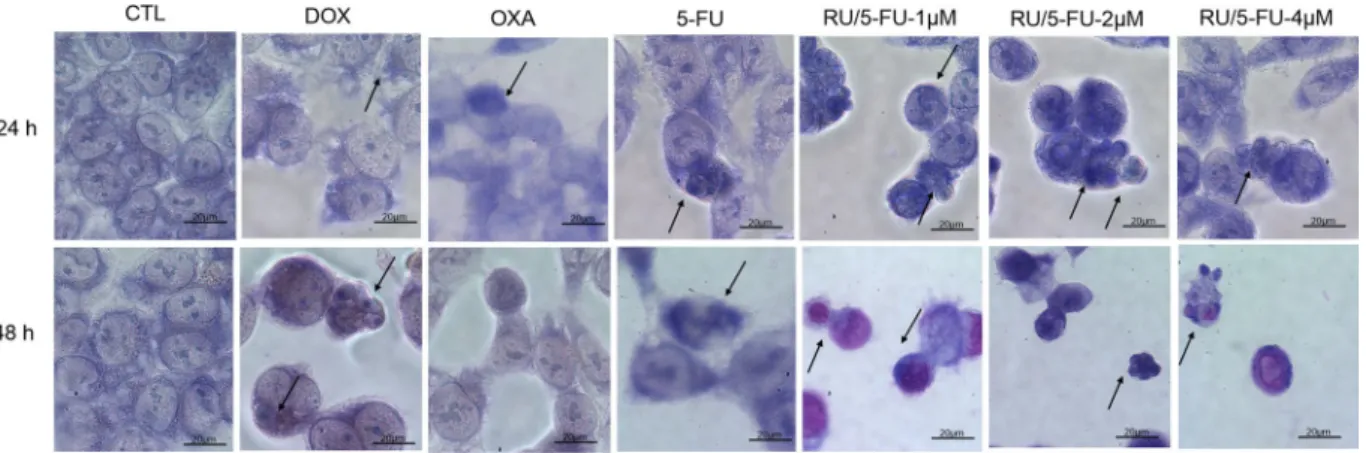 Figure 5.  Effect of the complex [Ru(5-FU)(PPh 3 ) 2 (bipy)]PF 6  (RU/5-FU) in the morphological analysis of  HCT116 cells after 24 and 48 h incubation