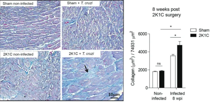 Figure 5. Collagen analysis in two-kidney one-clip (2K1C) infected cardiac tissue. Before and 8 weeks after 2K1C (n=8) and Sham (n=8) surgeries, immediately followed, or not, by infection with the Y strain of T