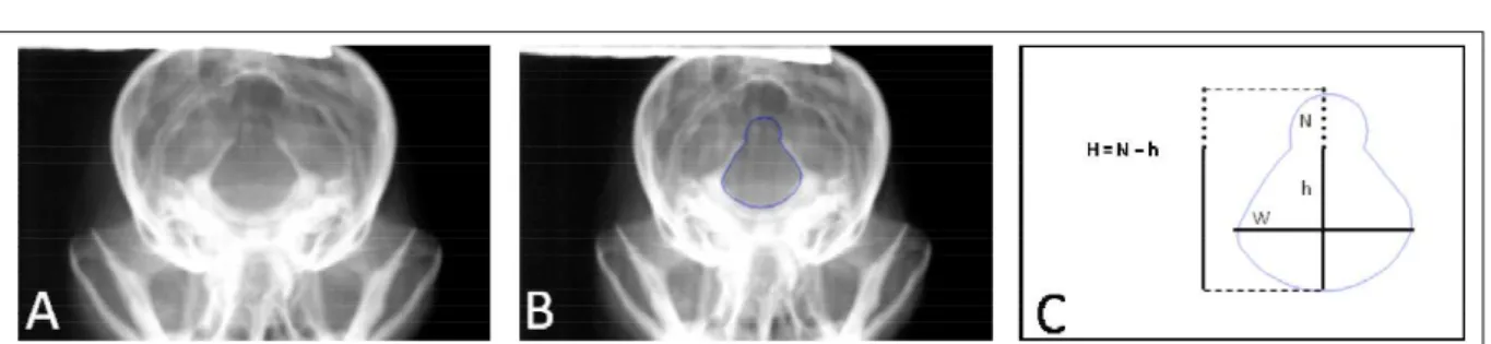 Figure  1  - A:  Digitized  image  of  skull  radiography  from  a Toy  Poodle  with  dorsal  enlargement  of  the  foramen  magnum