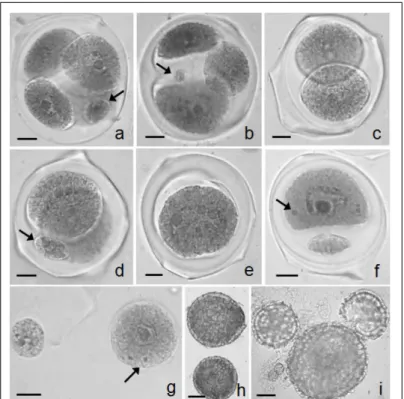 Figure 3 - Abnormal product meiotic. a) tetrad with microcyte (arrow); b) triad with microcyte; c) dyad; d) dyad with microcyte; e) monad;
