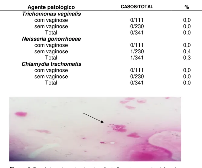 Tabela 10: Detecção de Trichomonas vaginalis, Neisseria gonorrhoeae e  Chlamydia trachomatis utilizando bacterioscopia pós-coloração de Gram 