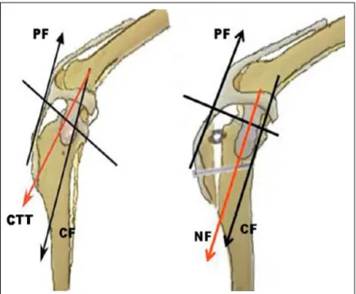 Figure 1 - Representative scheme of forces acting on stifle joint before (A) and after (b) modified TTA.