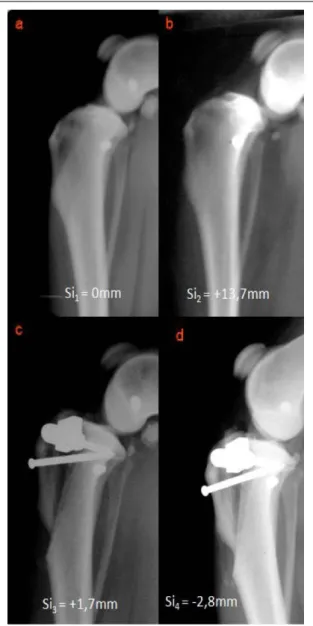 Figure 2 - Stress radiograph from one of the specimens used in this study. The reported values represent the means and standard deviations of tibial Subluxation (Si) with intact joint (A) and after successively CrCL transection (B), modified TTA stabilizat