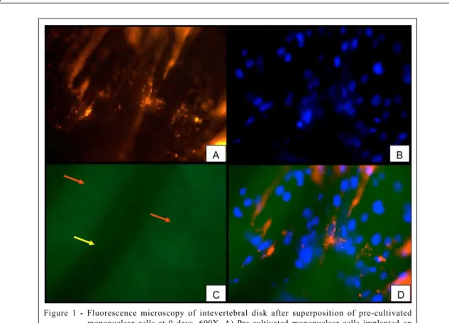 Figure 1  - Fluorescence microscopy of intevertebral disk after superposition of pre-cultivated mononuclear cells at 9 days, 600X