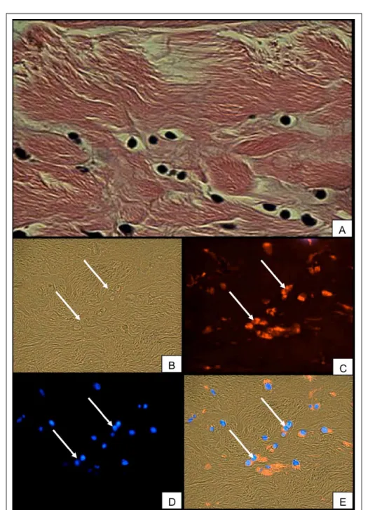 Figure 2 - Histopathology exam on annulus fibrosus section, 600X. A) H&amp;E stain on a section of the annulus fibrosus, 600X