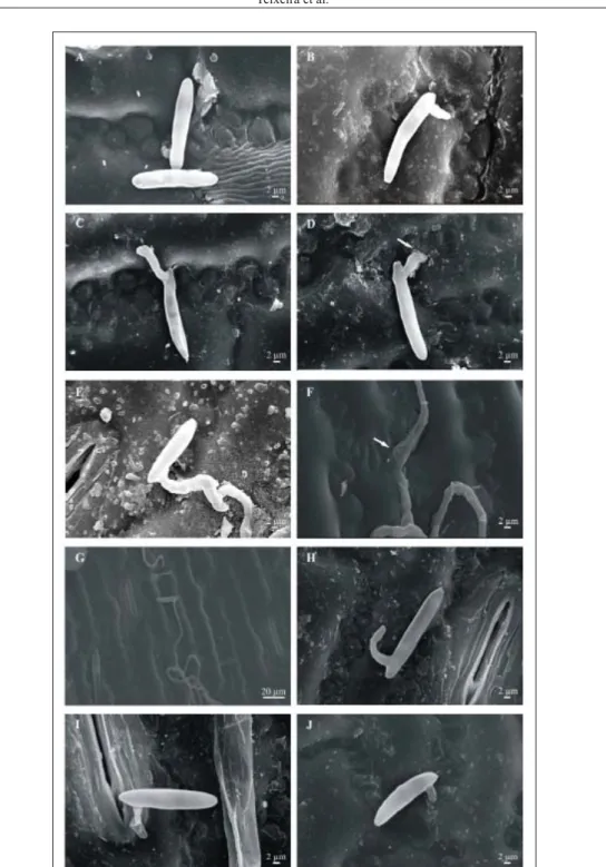 Figure 2 - Scanning electron micrographs of corn leaves inoculated with Stenocarpella  maydis (A–F) and treated with essential oils (G–J)