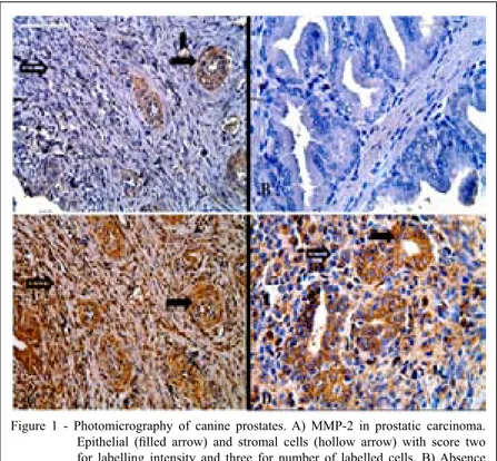 Figure 1 - Photomicrography of canine prostates. A) MMP-2 in prostatic carcinoma. 
