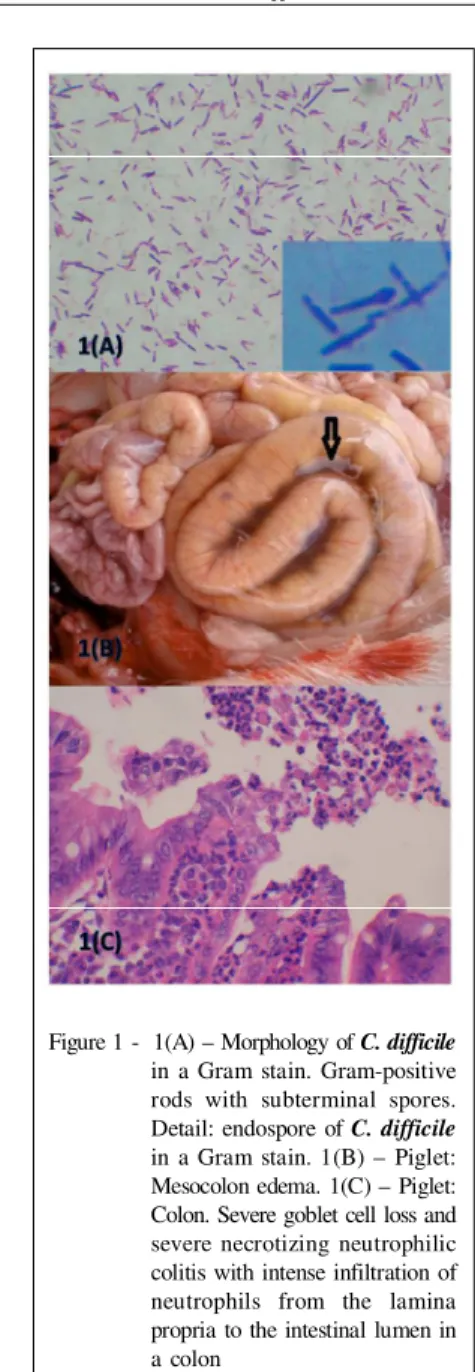 Figure 1 -  1(A) – Morphology of C. difficile in  a  Gram  stain.  Gram-positive rods  with  subterminal  spores.