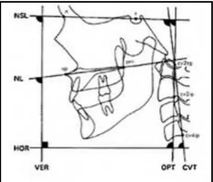 Figura  6  traçados  para  avaliação da postura  crânio-cervical  propostos  por  Solow  e  Tallgren  em  1976