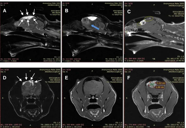 Figura 1. Imagens da RM do neurocrânio do animal 1. A e B: Imagens sagitais em T2-W onde  é  possível  observar  uma  lesão  lobulada  e  hiperintensa  em  relação  aos  tecidos  circundantes  saudáveis, com extensão desde a parte caudal do osso frontal at