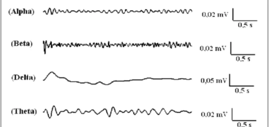 Figure 4 - EEG signal (epoch of 3s) after decomposition of frequency bands alpha, beta,  delta and theta.