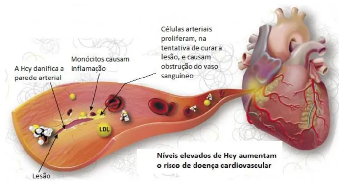 Figura 7 - Hiperhomocisteínemia e os danos vasculares (adaptado de Bioquimca  Clinica, 2010) 