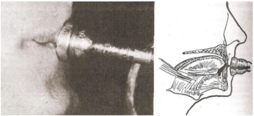 Figura 1 – Posição da boca e mandíbula durante a prática de trompete. (Herman, 1974) 