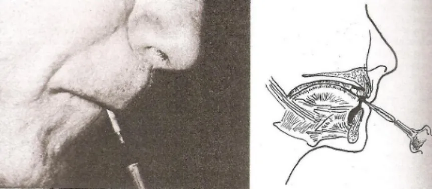 Figura 3 – Posição da boca e da mandíbula, durante a prática de oboé. (Herman, 1974) 