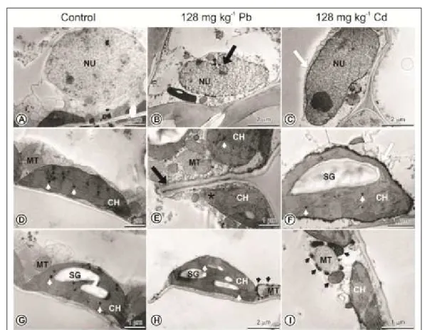 Figure 2- Transmission of electron photomicrographs of palisade parenchyma cells of the mesophyll of M