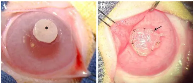 Figure 1 - A) omental graft (asterisk) in corneal bed prior to suture and coating with amniotic membrane (OM-graft group)